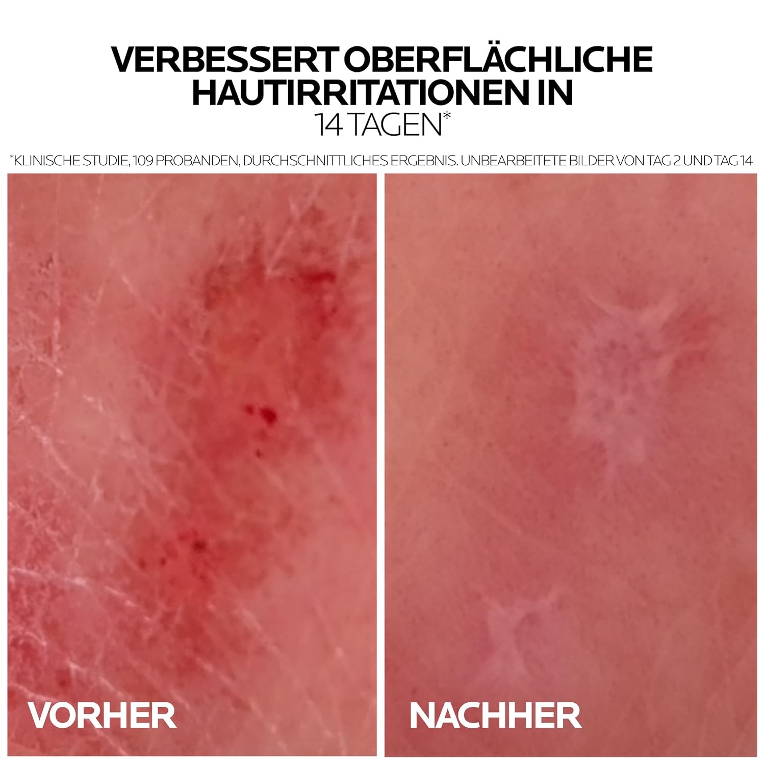image:imageLa RochePosay Cicaplast Baume B5 Reparierender WundpflegeBalsam 100 ml